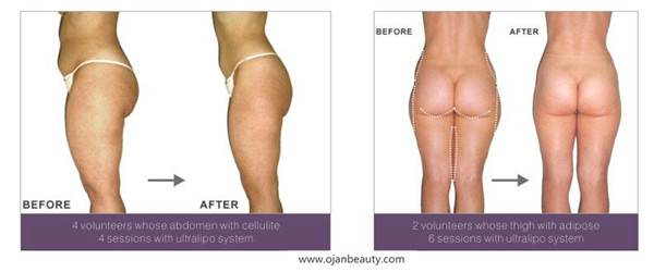 slimming before and after .jpg