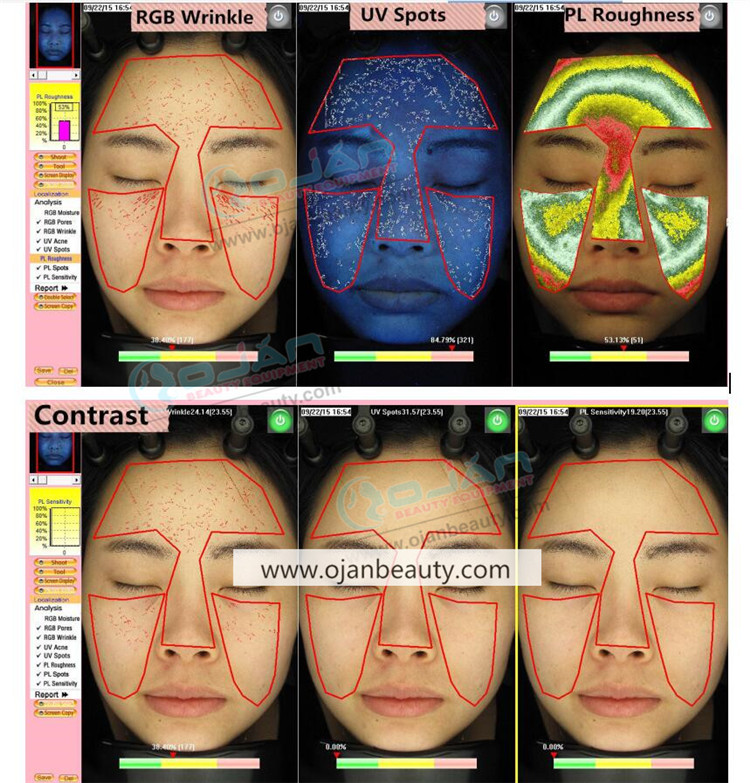 magic mirror skin analyzer (4).jpg