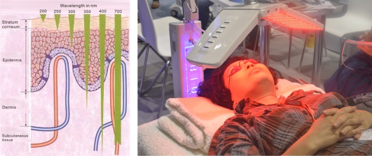 pdt led light therapy