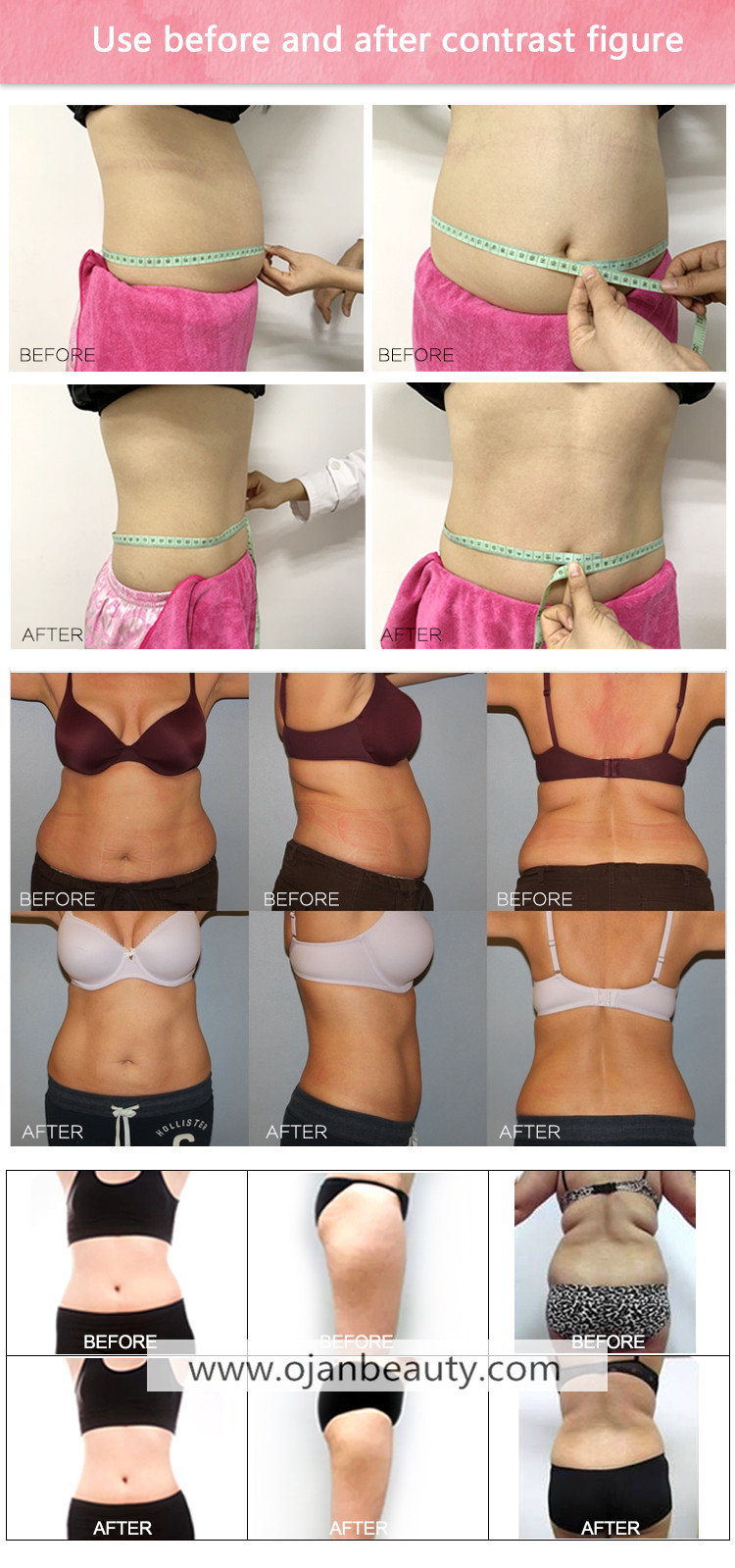 4D Diode Laser slimming 