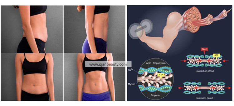 slimbeauty hiemt body slimming machine  