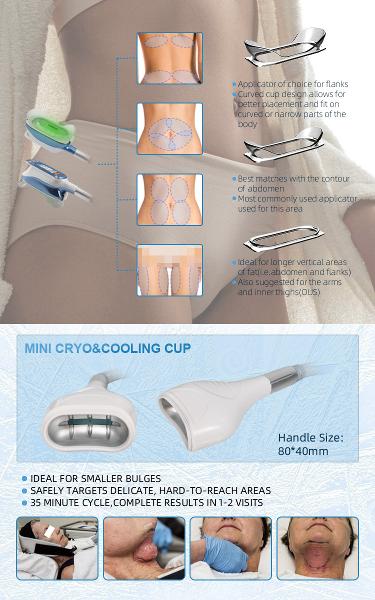     Cryolipolysis 