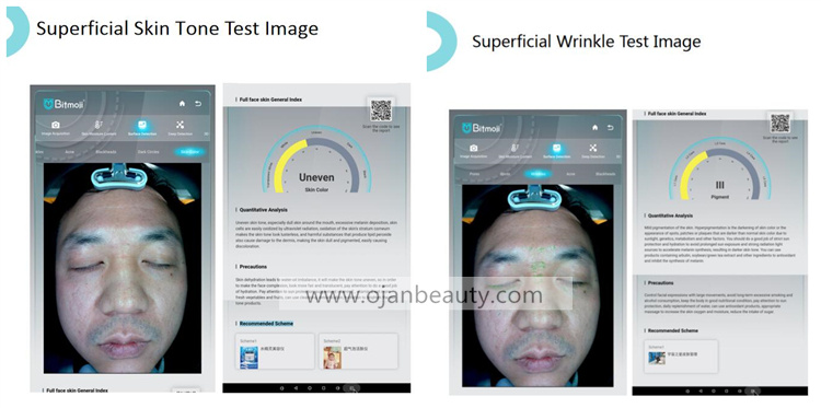 skin analyzer professional