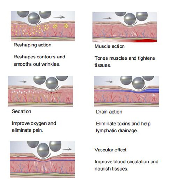 endospheres therapy